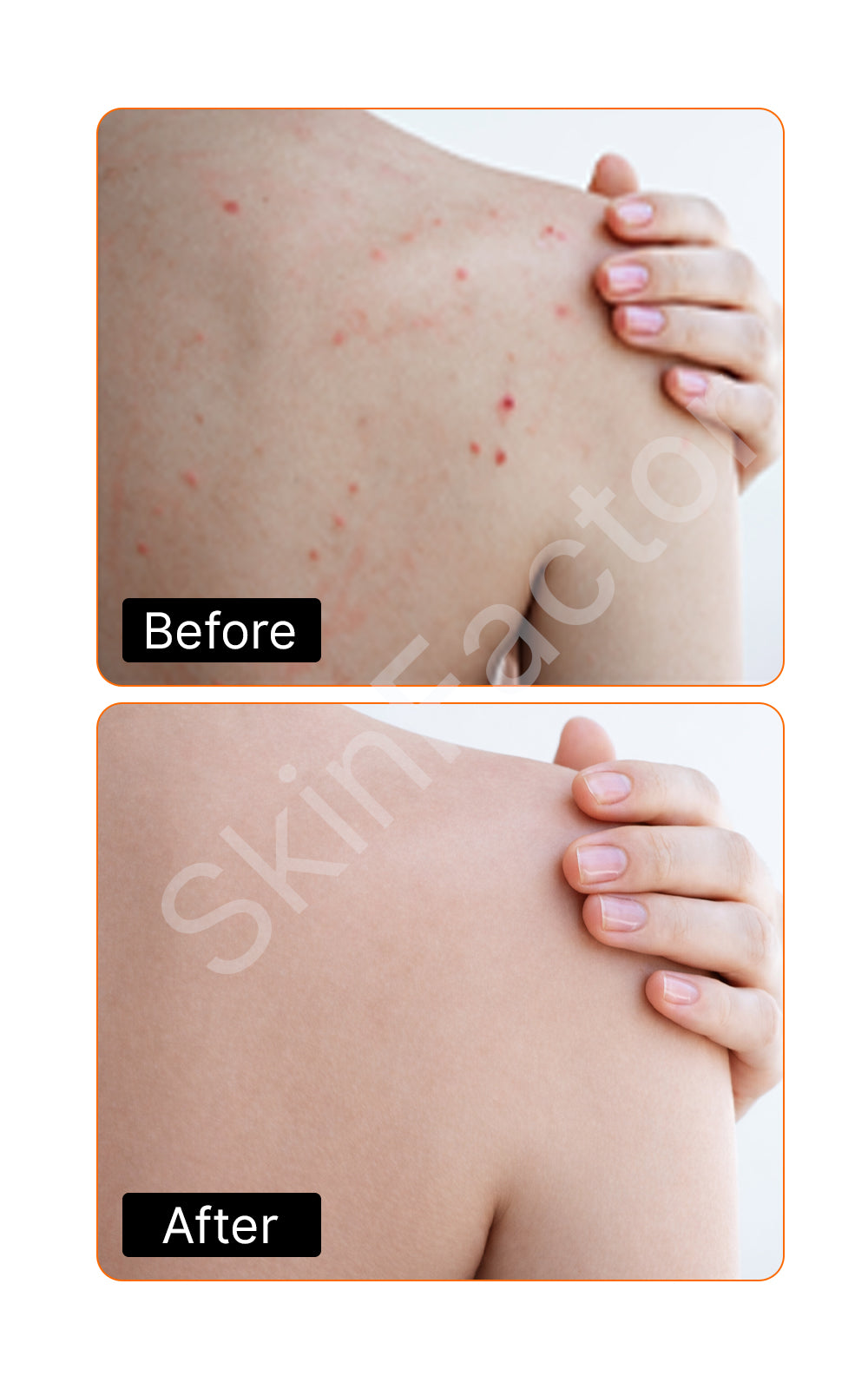 7% AHA/BHA Exfoliating Body Wash