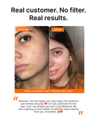 Anti Pigmentation Duo