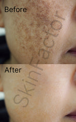 2% Kojic Acid Face Cream