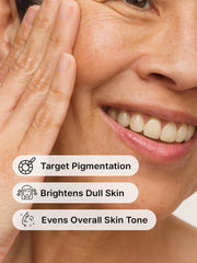 Anti Pigmentation Kit