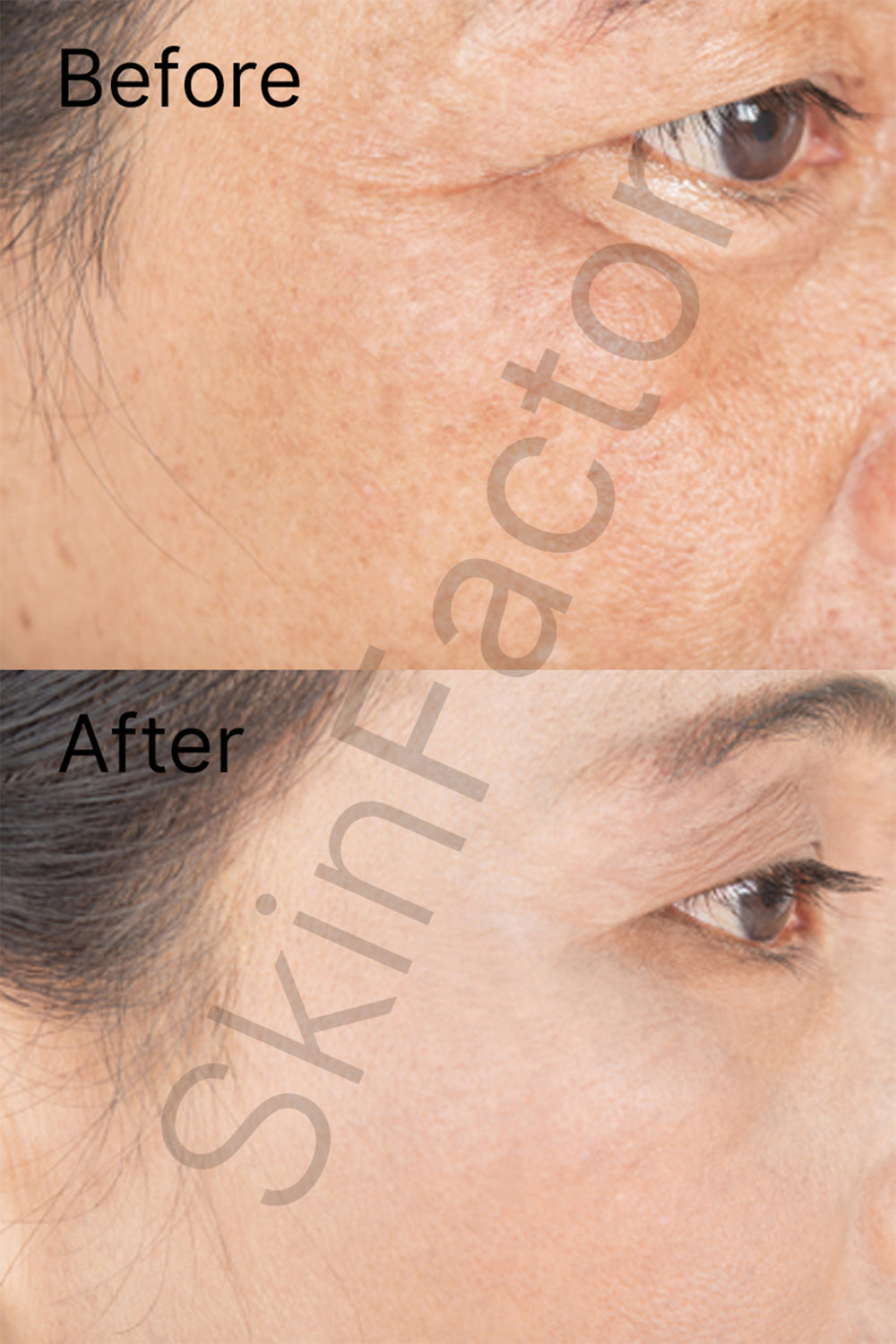 Retinol Serum Before after
