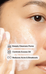 2% Salicylic Acid Face Wash