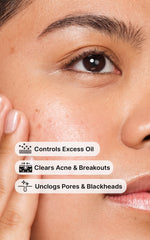2% Salicylic Acid Gel Cleanser