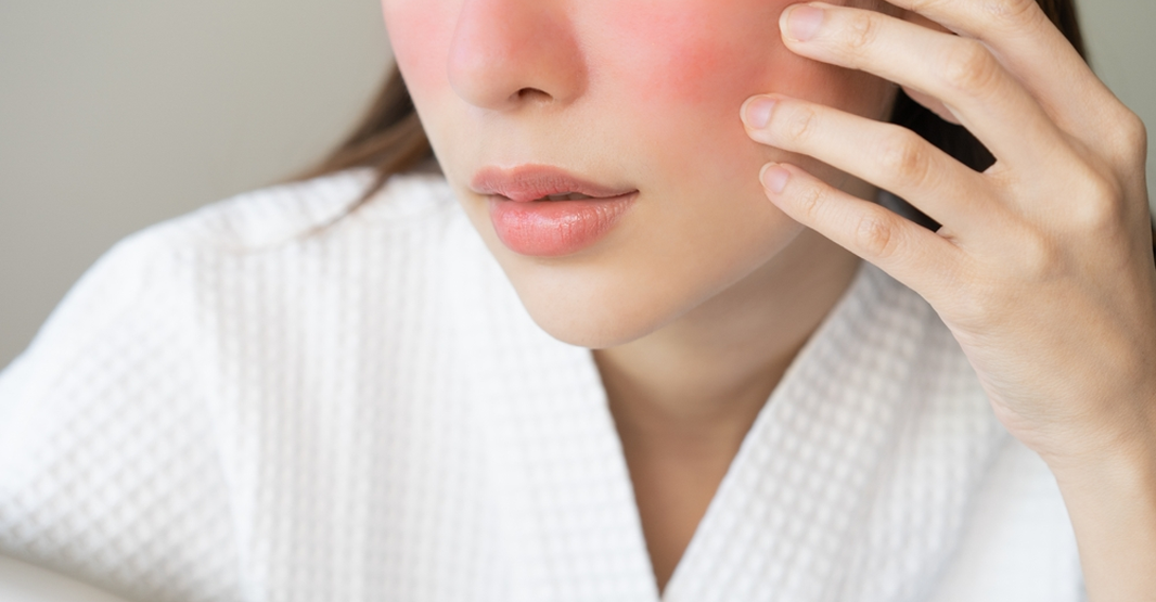 Bridal Skincare for Sensitive Skin