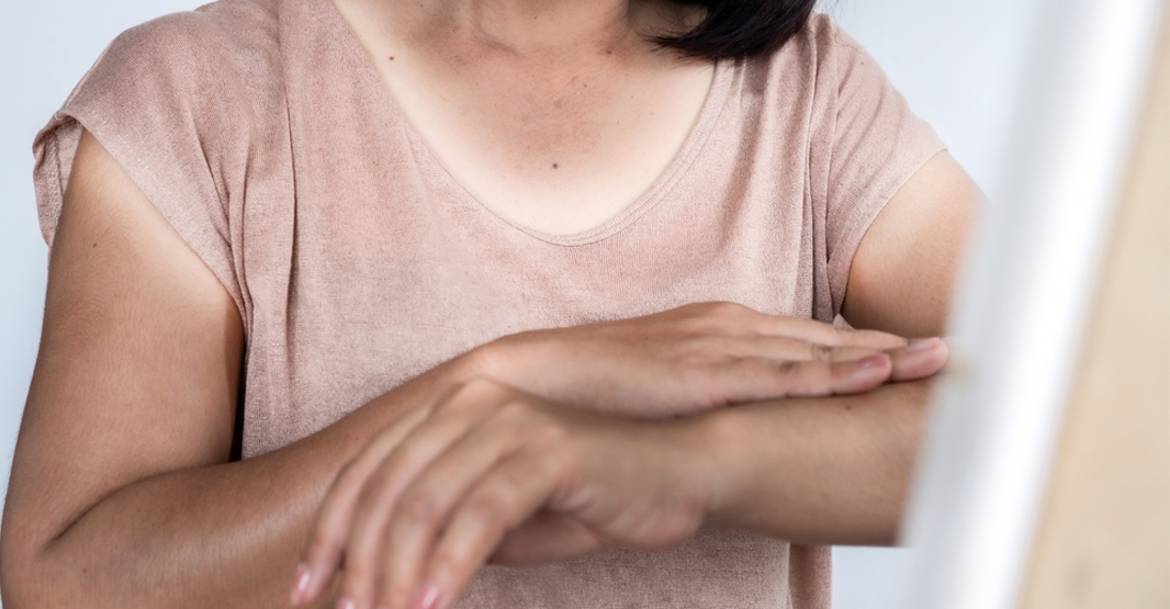 Causes Dark Spots and Pigmentation