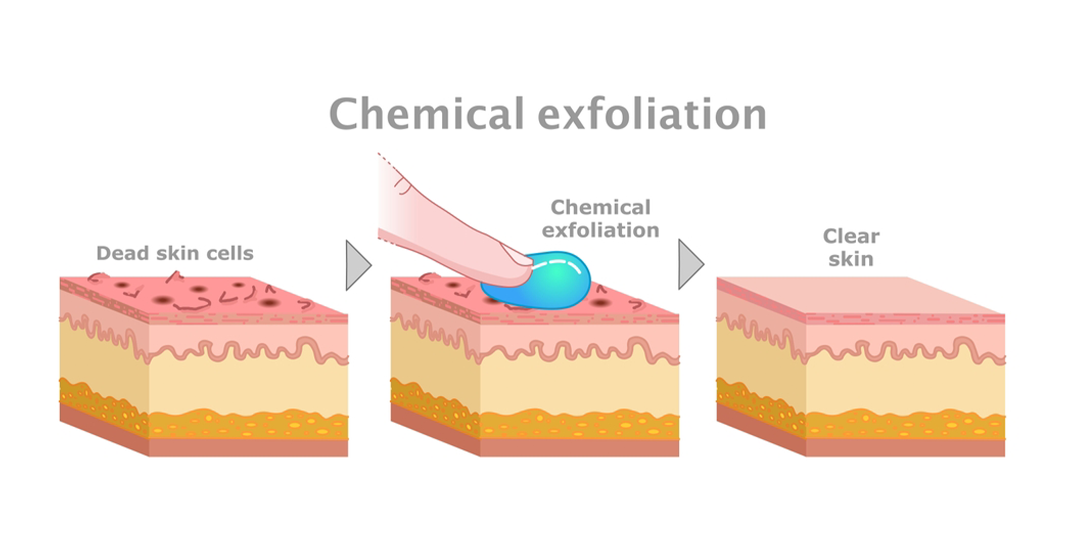 What Is Chemical Exfoliation and How Does It Work?