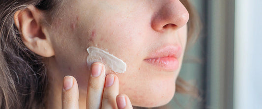 Dermatologist Insights: Who Should Avoid Salicylic Acid