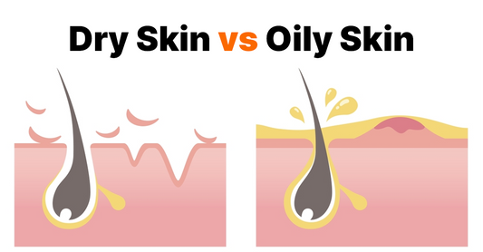 Dry Skin vs Oily Skin in Pakistan