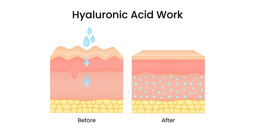 How Hyaluronic Acid Works for Dehydrated Skin in Pakistan