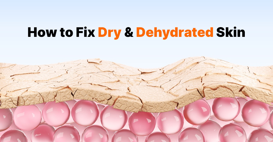 How to Fix Dry and Dehydrated Skin in Pakistan