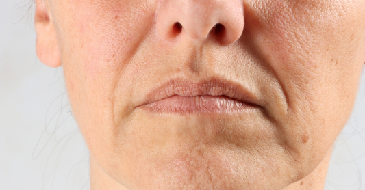 What Causes Premature Ageing in Pakistan