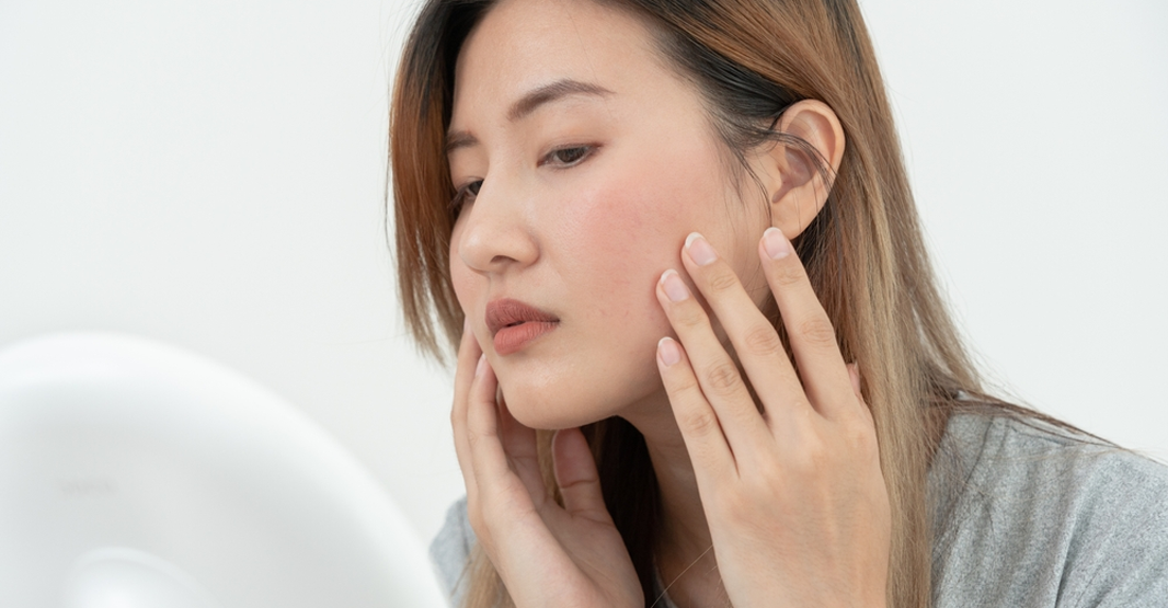 Sensitive Skin Care in Pakistan
