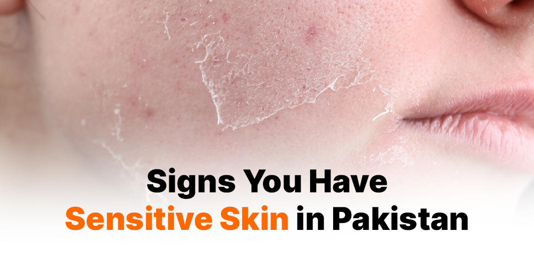 Signs You Have Sensitive Skin in Pakistan