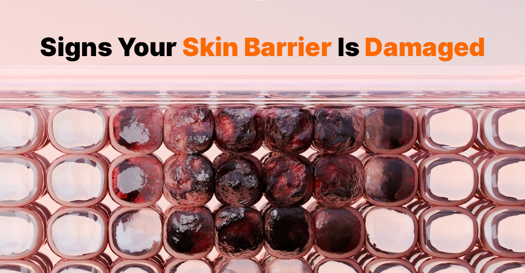 Signs Your Skin Barrier Is Damaged