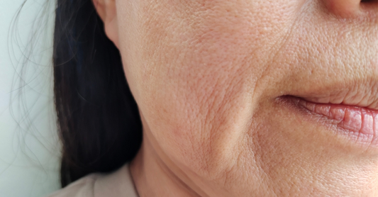 Signs of Skin Ageing in Pakistan
