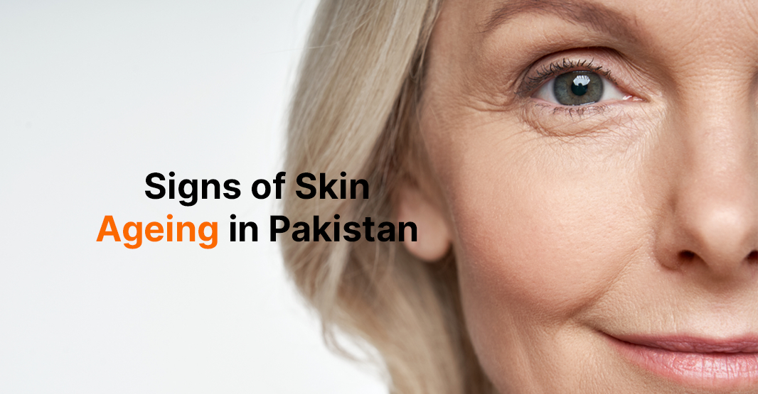 Signs of Skin Ageing in Pakistan