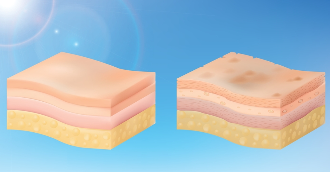 Signs of UV Damage on Pakistani Skin