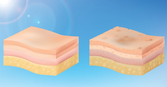 Signs of UV Damage on Pakistani Skin