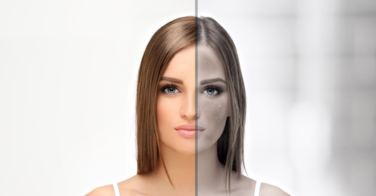 Skin Brightening vs Skin Bleaching in Pakistan: What Is the Difference?