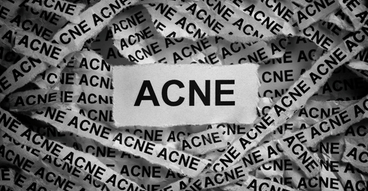 types-of-acne-pakistan