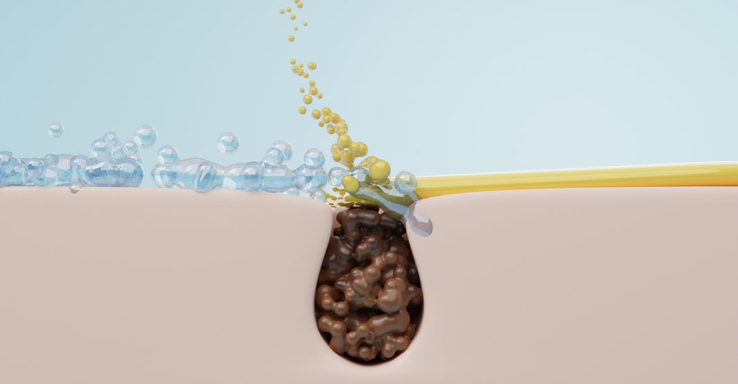 How Salicylic Acid Unclogs Pores: The Science Explained