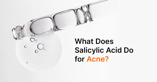 What Does Salicylic Acid Do for Acne?