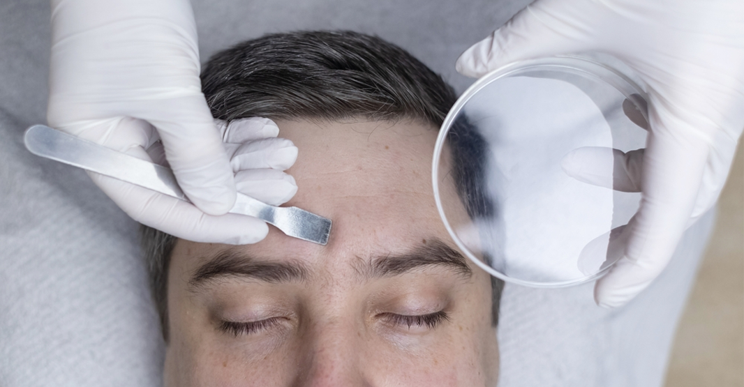 When to See a Dermatologist vs Try Skincare First