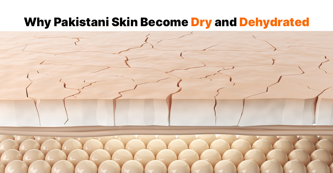 Why Pakistani Skin Becomes Dry and Dehydrated