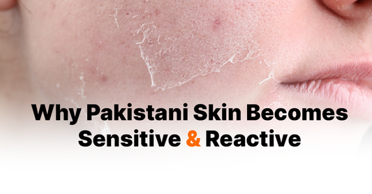 Why Pakistani Skin Becomes Sensitive and Reactive