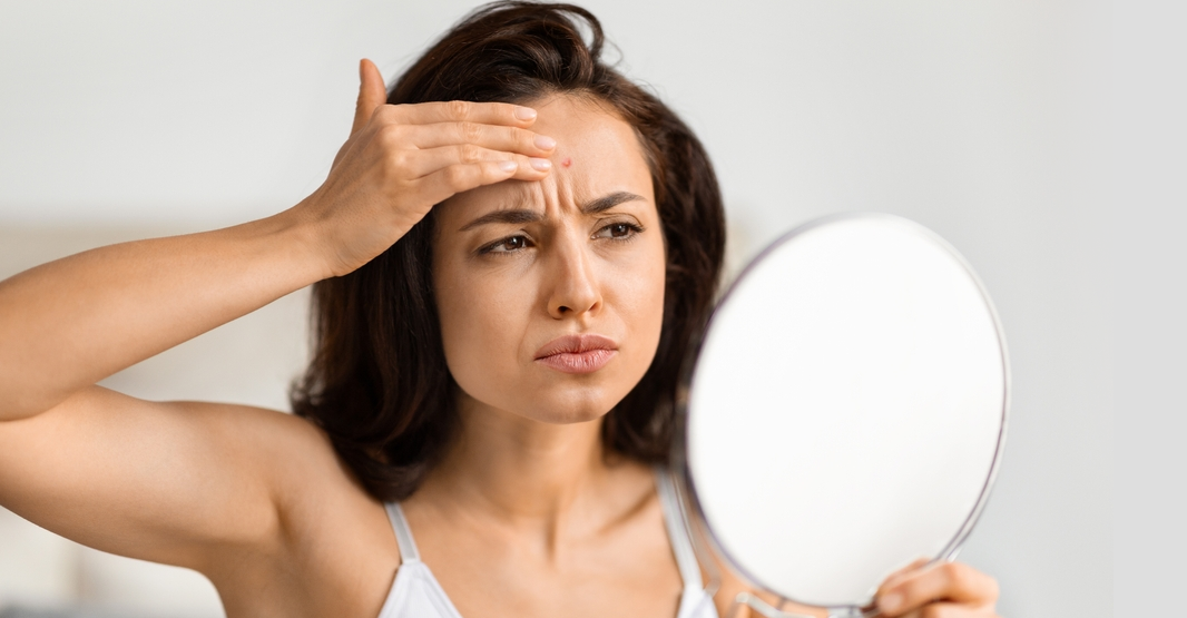 Why Pakistani Skin Looks Dull: The Real Causes