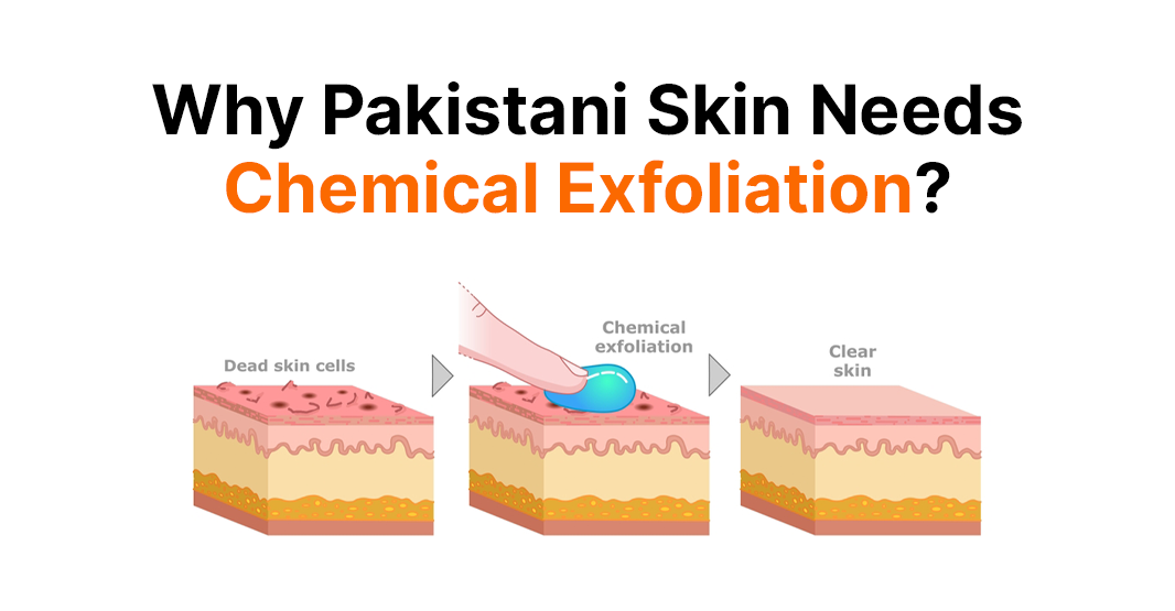 Why Pakistani Skin Needs Chemical Exfoliation