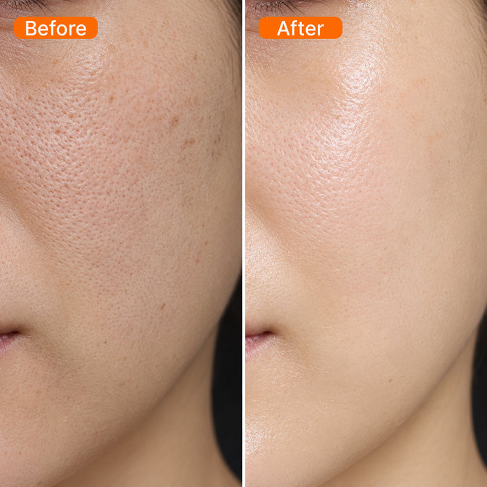 Before and after results