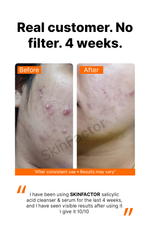 Customer-Before-After