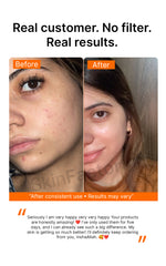 2% Kojic Acid Face Cream