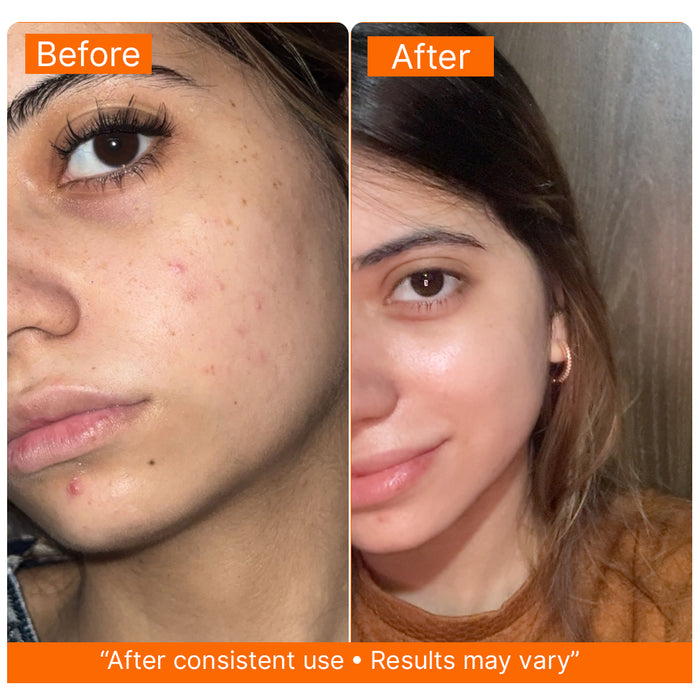 Before and after results