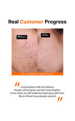 2% Salicylic Acid Gel Cleanser