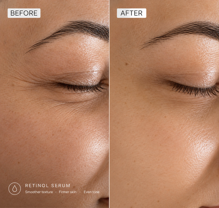 Before and after results