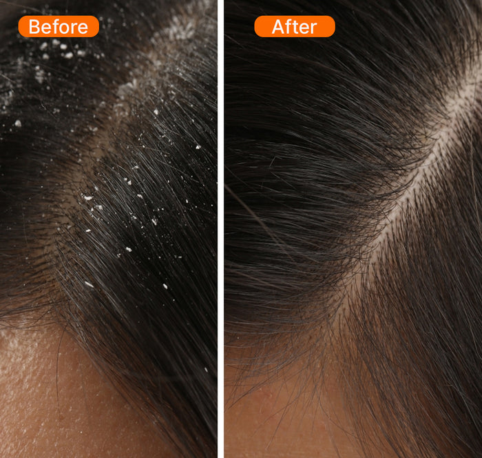 Before and after results