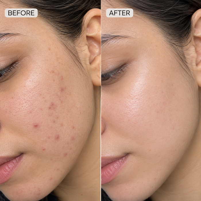 Before and after results