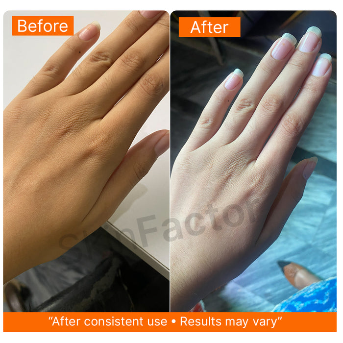 Before and after results