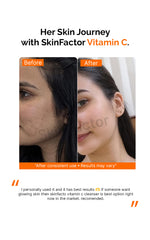 Vitamin C Skin Brightening Kit