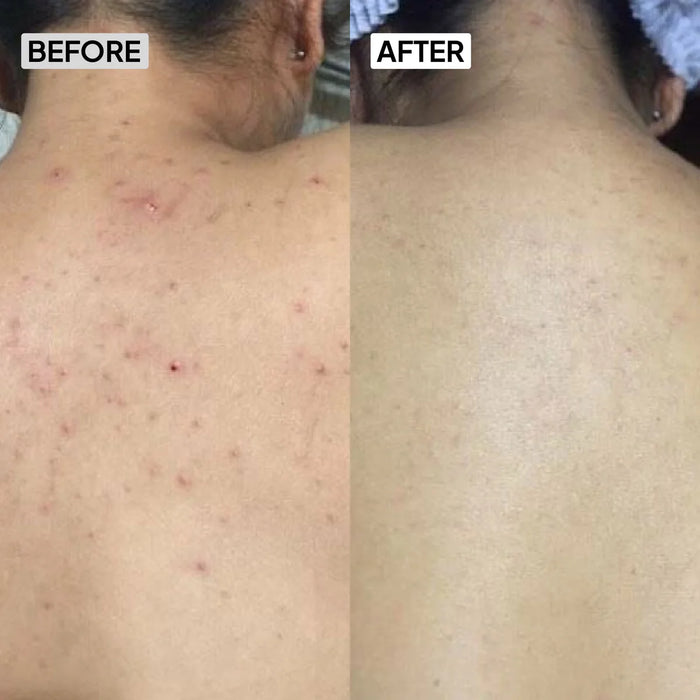 Before and after results